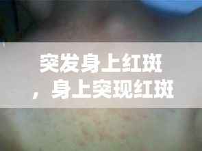突发身上红斑，身上突现红斑是什么原因 