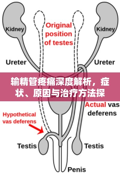 输精管疼痛深度解析，症状、原因与治疗方法探讨